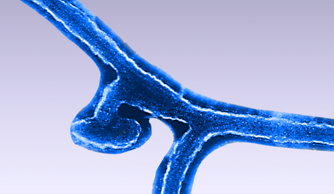 Marburg Virus. First-Ever Disease Outbreak. Equatorial Guinea