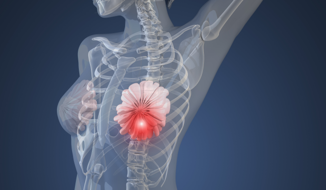 Polish Scientists Unleash New Hope for Triple-Negative Breast Cancer Treatment 